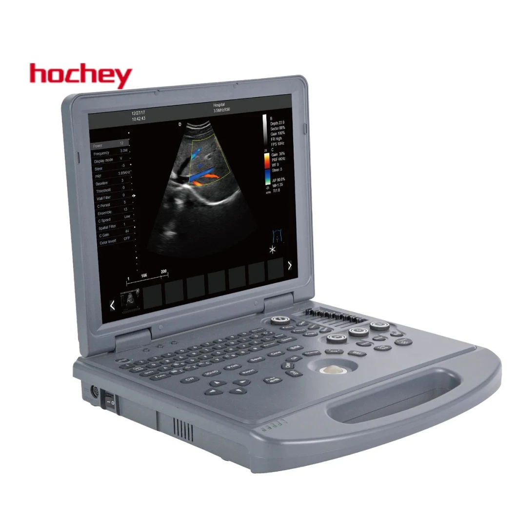 Hochey Medical Wireless Ultrasound Probe Large LED Screen 4D Mode Color Doppler Laptop Type Scanner for Body Examine